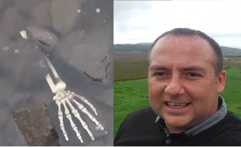 Moment Treasure Hunter Thought He'd Found Found Human Remains - But ...