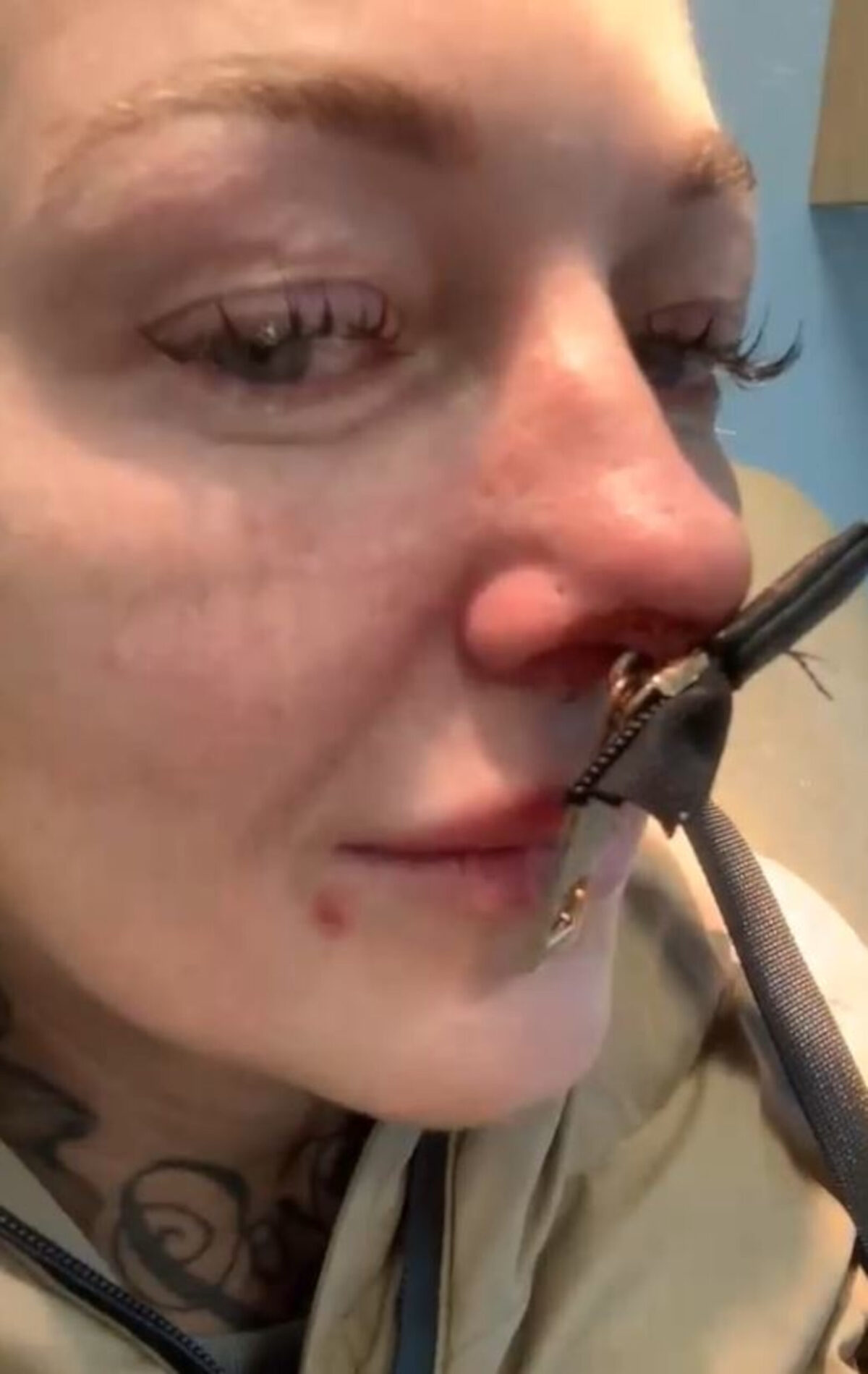 Woman left in tears after getting handbag zip stuck through her nose in  freak accident - Mirror Online