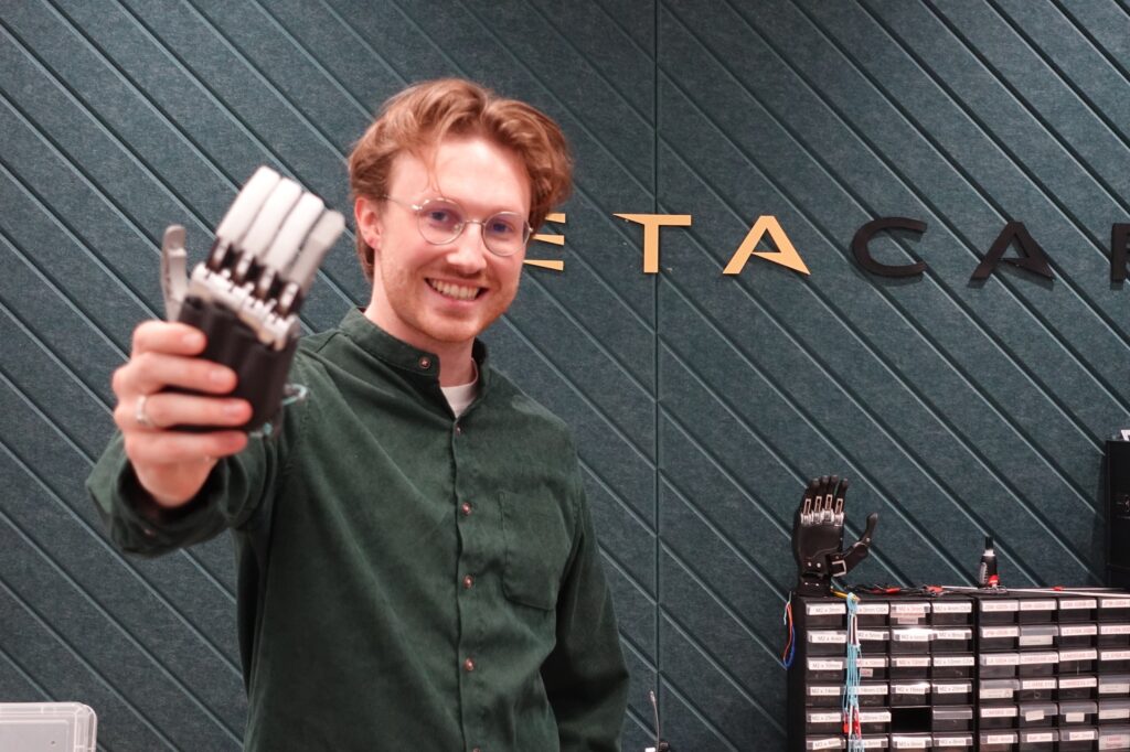 Metacarpal founder, Fergal Mackie with his mechanical prosthetic. Image supplied with release by Frame Creates.