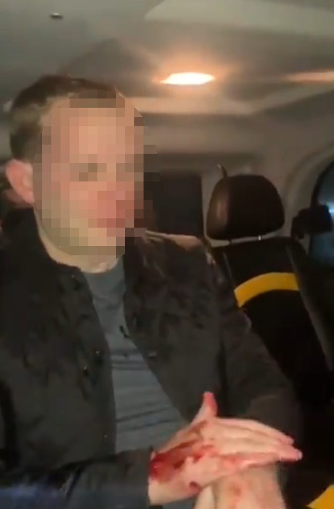 A TAXI driver has recorded himself chastising a man in the back of his cab after allegedly chasing him and a friend down and beating them for trying to escape without paying. 